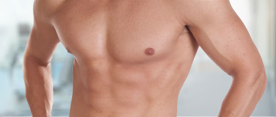 Male Gynecomastia Gallery